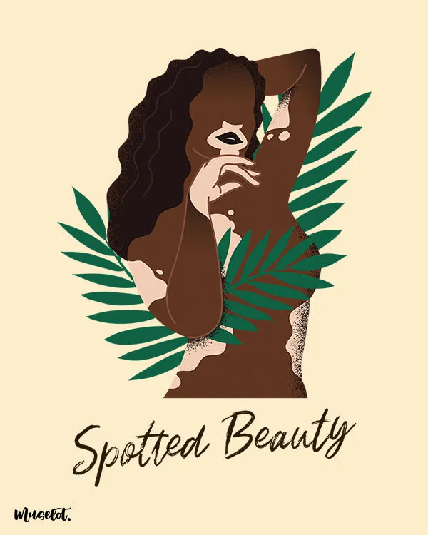 Spotted beauty posters
